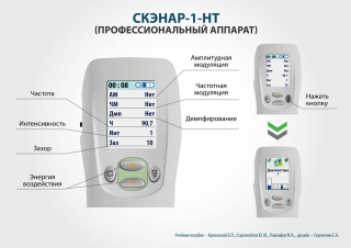 СКЭНАР-1-НТ (исполнение 01)  в Миассе купить Медицинская техника - denasosteo.ru 